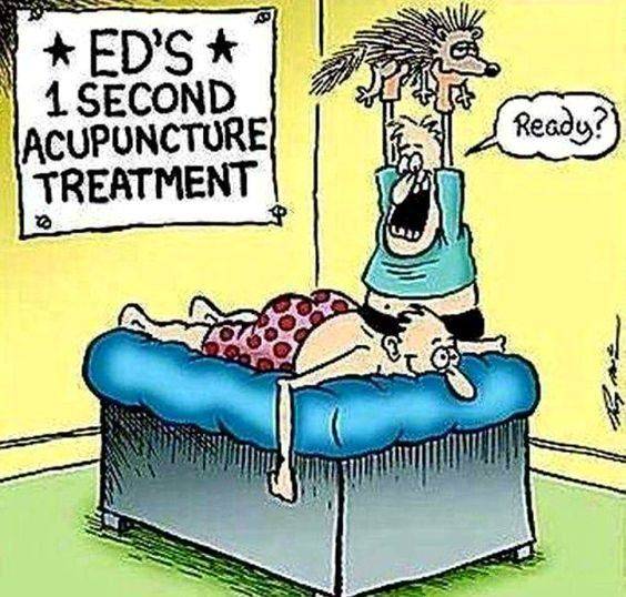 1 sec acupuncture treatment.jpg