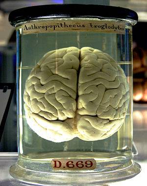 300px-Chimp_Brain_in_a_jar.jpg