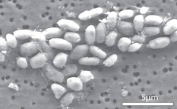 350px-GFAJ-1_%28grown_on_arsenic%29.jpg