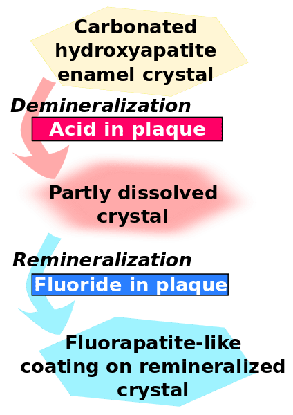 424px-Enamel-fluoride-remineralization.svg.png