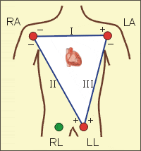 A013_Einthovens_triangle.gif