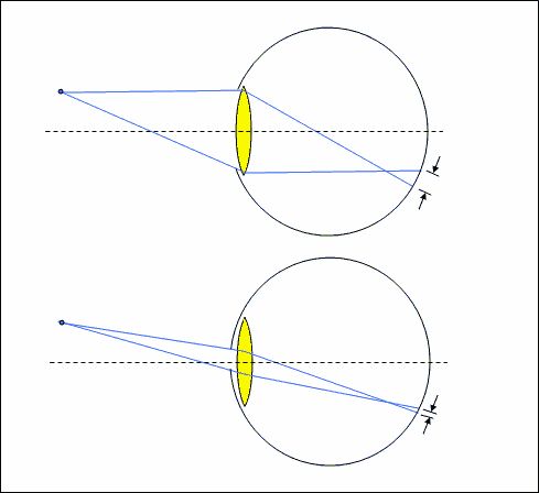 ApertureEffectEye.gif