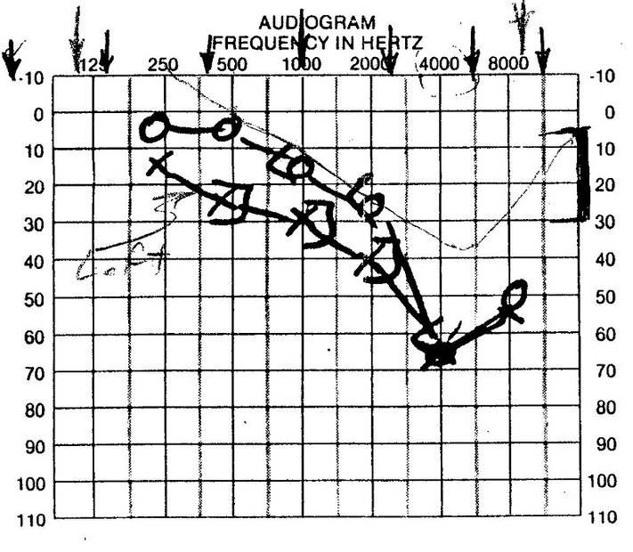 Audiogram.jpg