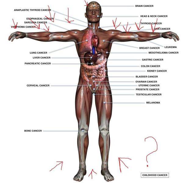 body.jpg