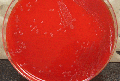 identifying bacteria on agar plates