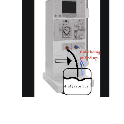 dialysate.png
