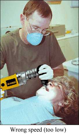 Drill-Dental-B.jpg