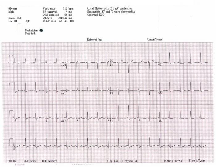 ECG+What+Is+It+3.jpg