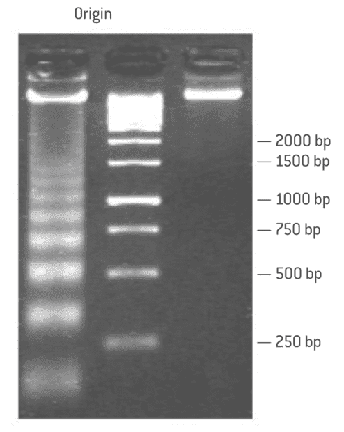 Electrophoresis.png