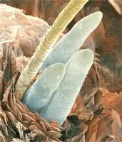 eyelashmitesqw1.jpg
