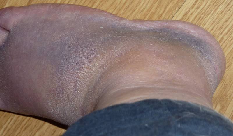 foot.jpg