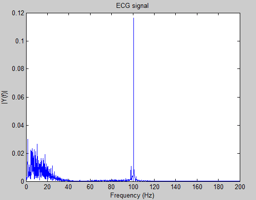 Question about ECG filters