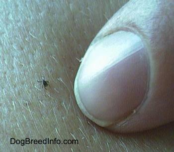 Lyme_Tick_1.JPG