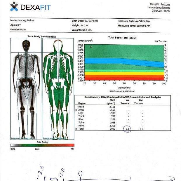 nsima inyang's bone mineral content and bone mineral density 1.jpg