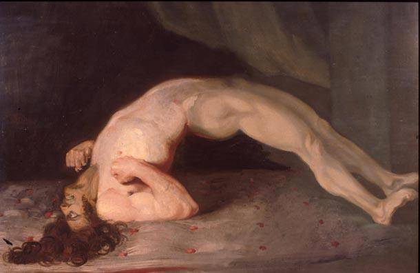 Opisthotonus_in_a_patient_suffering_from_tetanus_-_Painting_by_Sir_Charles_Bell_-_1809.jpg
