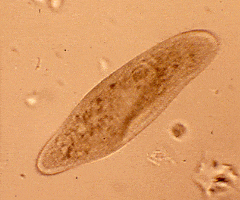 paramecium1.gif