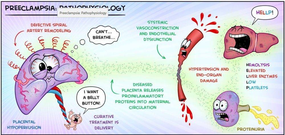 preeclam cartoons.JPG