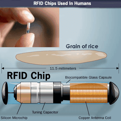 rfid-chip-obamacare.png