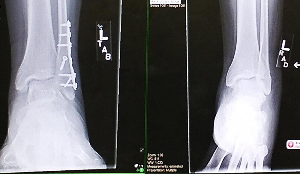 xray.jpg