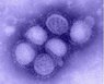 H1N1-CDC-02.jpg