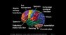 Brain1.jpg