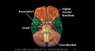 Brain2.jpg