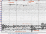181114-15  UT M6.2 Kamchatka Penin, 6.3 Sandwich Isl, 6.3 EPR zhi annotated.GIF