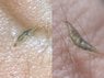 PF20110711_bug.jpg