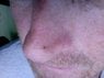 nose.jpg