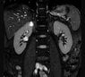 kidney.jpg