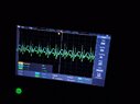 PID when scanning(feedback is not connected).jpg