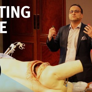 Surgery From Scalpels to Robots - with Pankaj Chandak