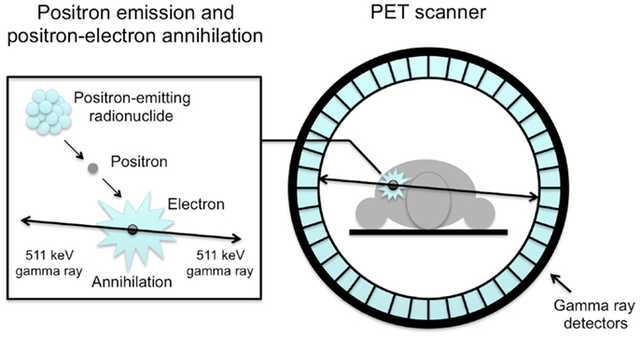 how pet scanner works