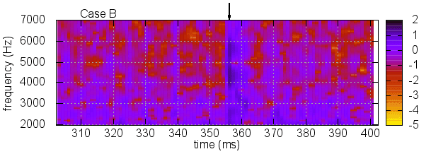 sound-spectrogram