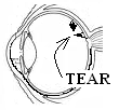 Retina Image